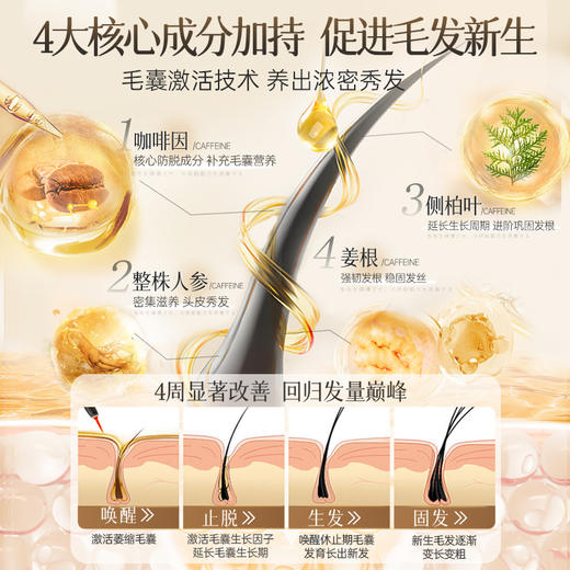 养发液头发际线护理精华营养液剂滋养头发男女生长防脱发正品 商品图6