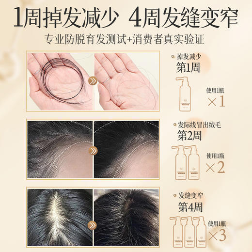 养发液头发际线护理精华营养液剂滋养头发男女生长防脱发正品 商品图5