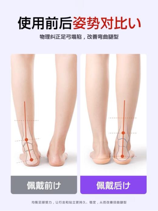 🔹【Zeamo专利款足弓矫正支撑鞋垫】✅ 符合健康足弓の要求、专业设计，强力支撑🎊 商品图1