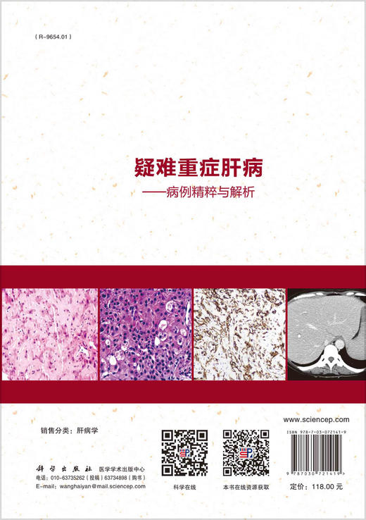 疑难重症肝病：病例精粹与解析/游绍莉 吕飒 朱冰 商品图1