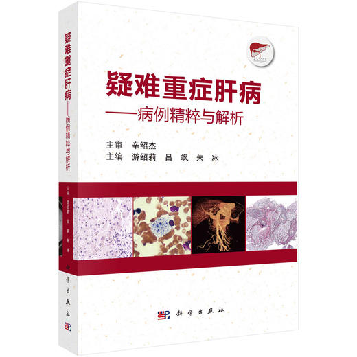 疑难重症肝病：病例精粹与解析/游绍莉 吕飒 朱冰 商品图0