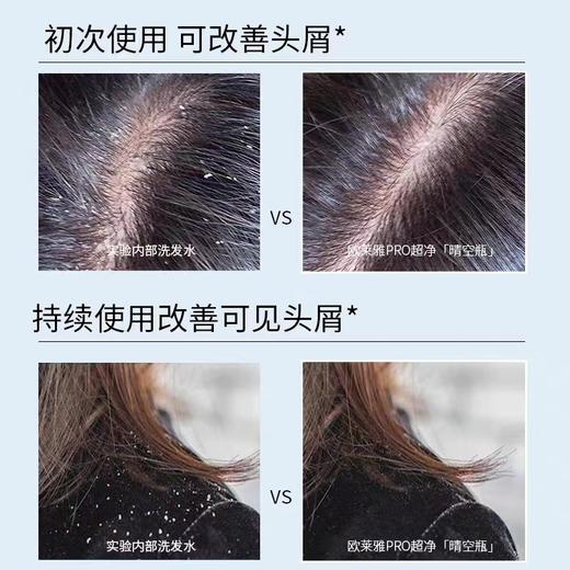 进口欧莱雅PRO超净晴空瓶去屑止痒洗发水控油无硅油沙龙洗发水500ml 商品图3