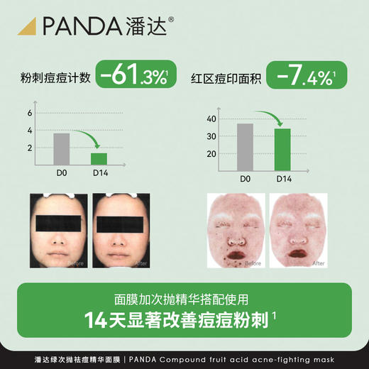 【任选3件】潘达祛痘次抛精华面膜淡化红区皮损痘印粉刺紧致 商品图4
