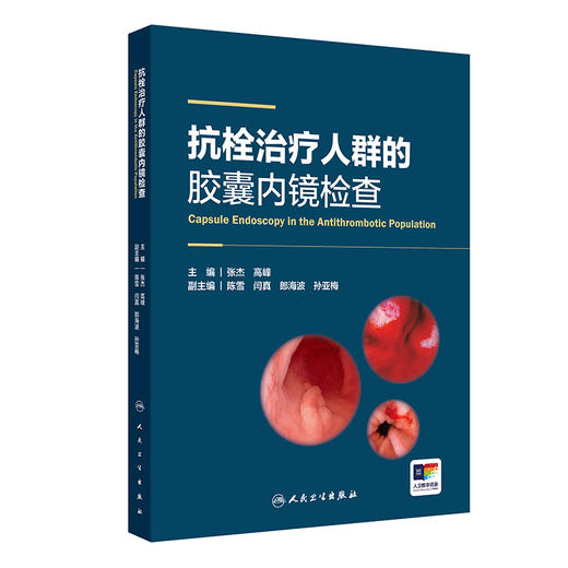 抗栓治疗人群的胶囊内镜检查 2024年6月参考书 商品图0