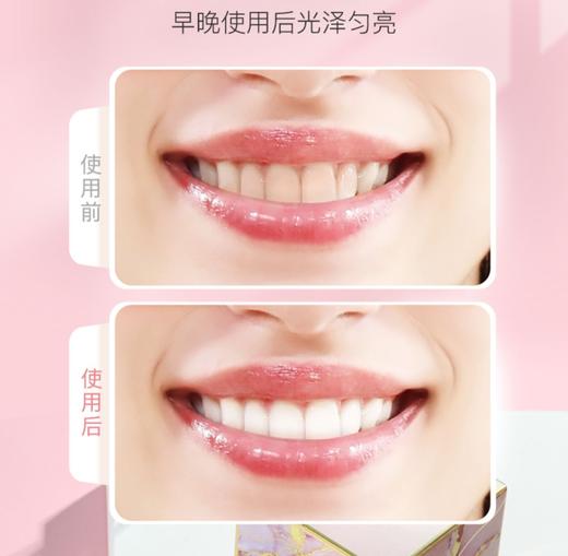 【7.6积分当钱花】Bodyaid玫瑰护龈牙粉50g*2（效期至24.10） 商品图2