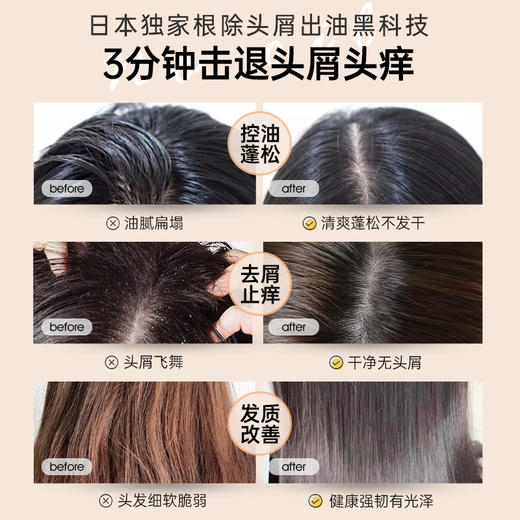 儒意氨基酸去屑控油洗发水500ml 控油蓬松 去屑止痒 无硅油除螨洗头膏露 | 儒意官方商城 商品图3