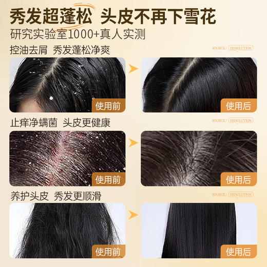 儒意玻尿酸水光洗发水500ml 控油蓬松 氨基酸无硅油 去屑止痒 除螨留香洗发露男女士 | 儒意官方商城 商品图4