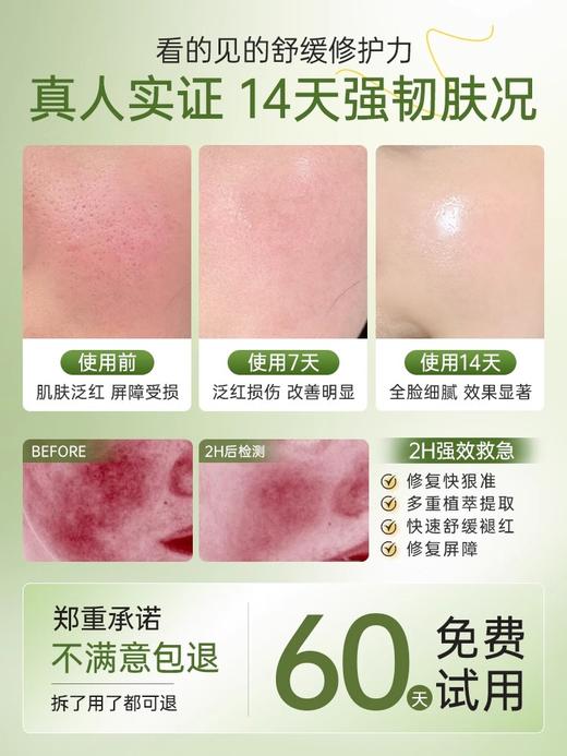 【烂脸救星 舒缓褪红修复】油橄榄舒缓修护精华液 30g（四方滴管瓶）#油橄榄精华液紧致抗皱面部补水祛痘舒缓修复褪红 商品图3