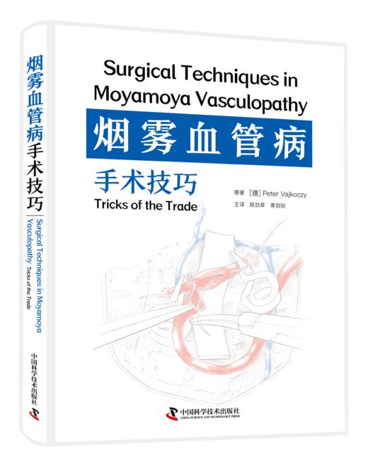 烟雾血管病血运重建专著《烟雾血管病手术技巧》陈劲草、章剑剑主译 商品图1