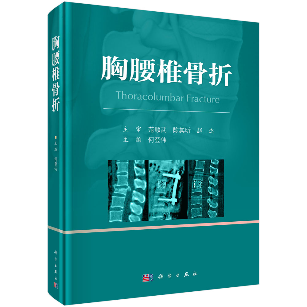 胸腰椎骨折/何登伟