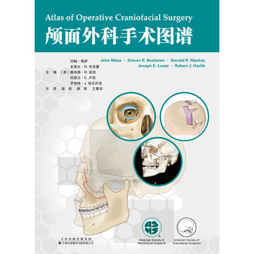 颅面外科手术图谱 颅面 颌面 头颈 耳鼻咽喉 外科 手术 技术 图谱 商品图3