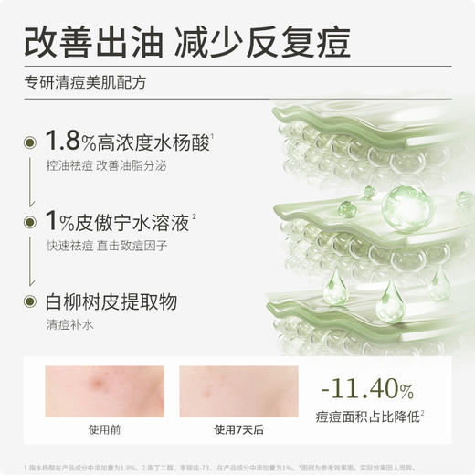 【任3件99元】【会员福利】水之蔻控油祛痘身体喷雾140ml 商品图5