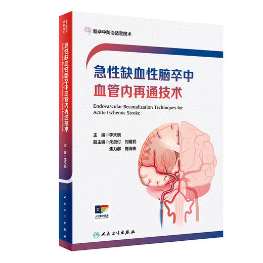 急性缺血性脑卒中血管内再通技术 附视频 李天晓 AlS血管内再通技术流程建设技术操作培训术后康复等 人民卫生出版社9787117362047 商品图1