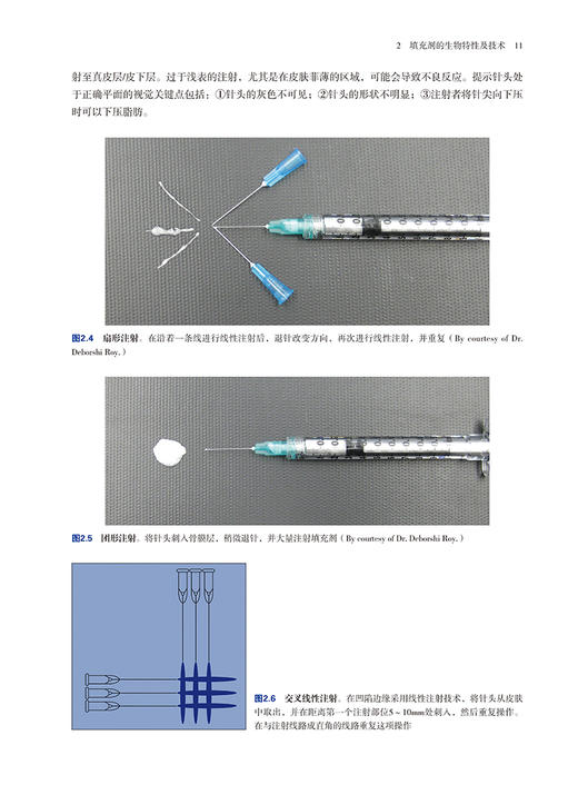 注射填充剂图解手册 第二版2版 刘庆阳 洪恺志 郭晓波主译 面部主要层次解剖 临床技术应用指导 辽宁科学技术出版社9787559135506 商品图3