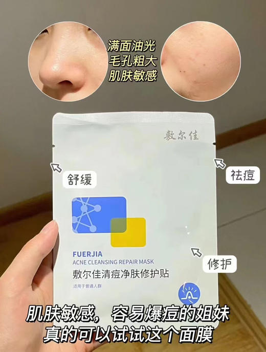 敷尔佳清痘修护贴面膜5片装淡化痘印舒缓 商品图12