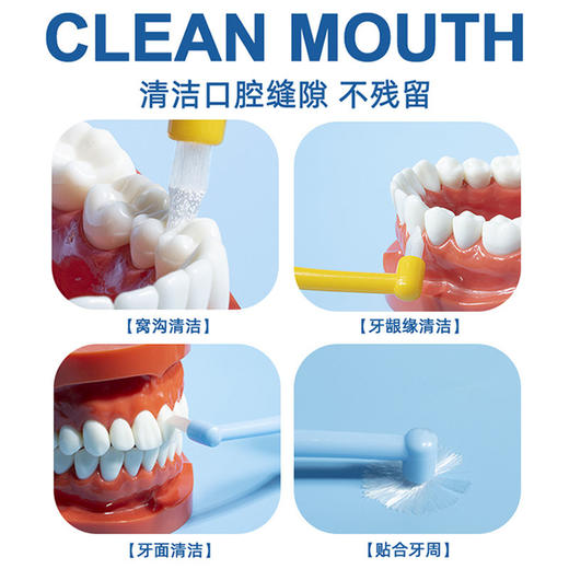 单束牙刷小尖头牙套矫正牙缝刷智齿窝沟正畸牙刷软毛 商品图2