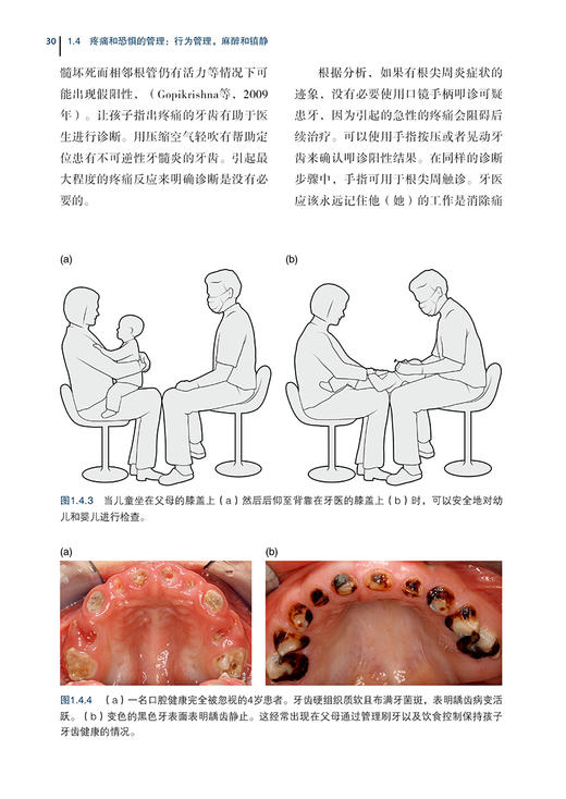 儿童与青少年牙齿急症治疗 薛晶 阙克华主译 口腔护理诊断技能治疗方案管理政策 医生指导手册 辽宁科学技术出版社9787559136015 商品图3