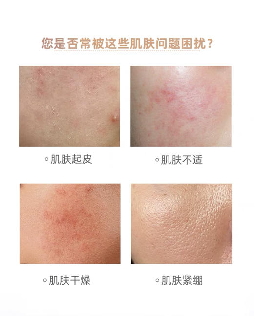 敷尔佳透明质酸钠次抛30支 修护精华液肌肤补水保湿修护脆弱 商品图4