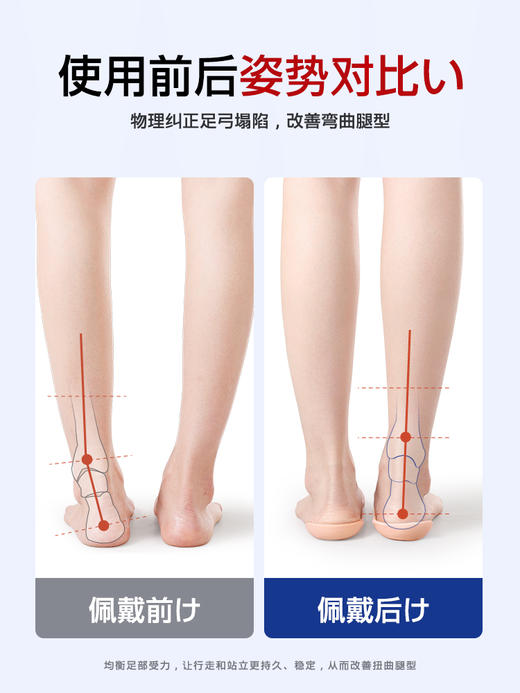 Zeamo专利款足弓矫正支撑鞋垫 商品图3