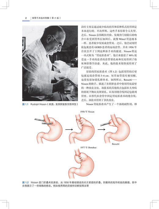 食管手术技术图解 第2版 陈龙奇 袁勇主译 食管疾病影像学检查功能检查 食管外科及介入治疗技术 上海科学技术出版社9787547866252 商品图3