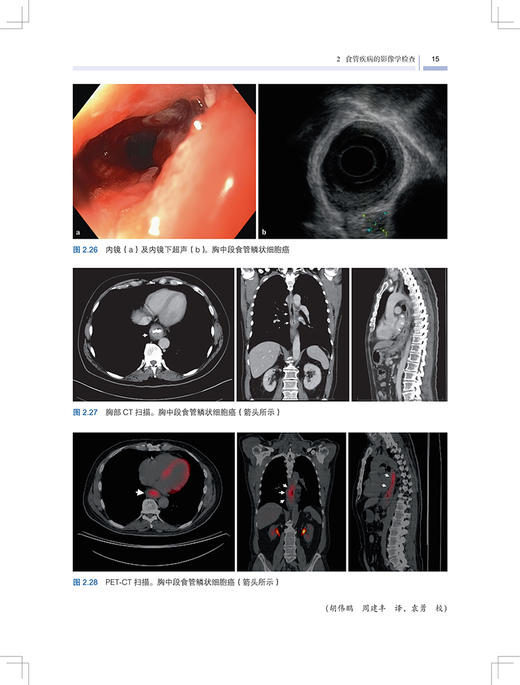 食管手术技术图解 第2版 陈龙奇 袁勇主译 食管疾病影像学检查功能检查 食管外科及介入治疗技术 上海科学技术出版社9787547866252 商品图4