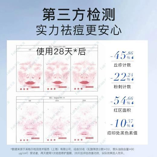 【中度痤疮/炎性丘疹/脓包】芙清 医用促愈功能性敷料（经典款面膜） 商品图3