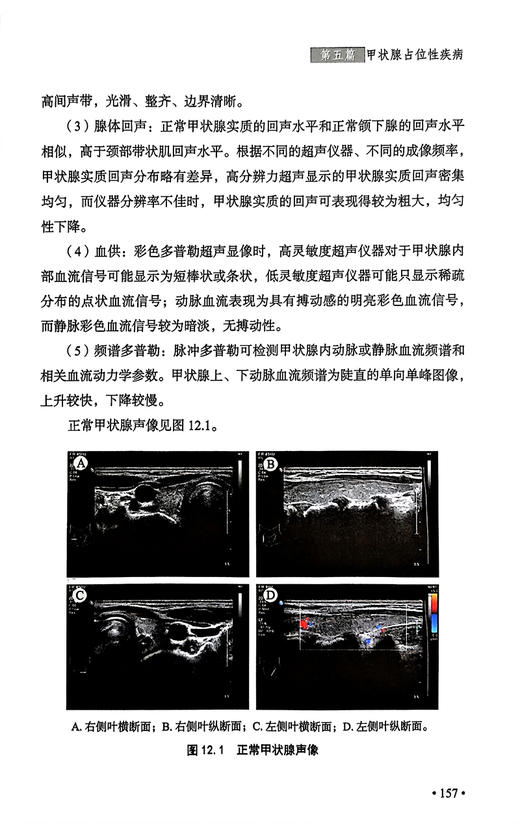 甲状腺疾病诊治基层实践手册 李舍予 罗晗 李治鹏 甲状腺疾病相关检查鉴别诊断治疗方案疾病管理 科学技术文献出版社9787523513736 商品图4