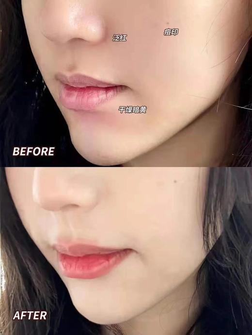 娇YUN诗黄金双萃精华干皮救星混合皮 商品图11