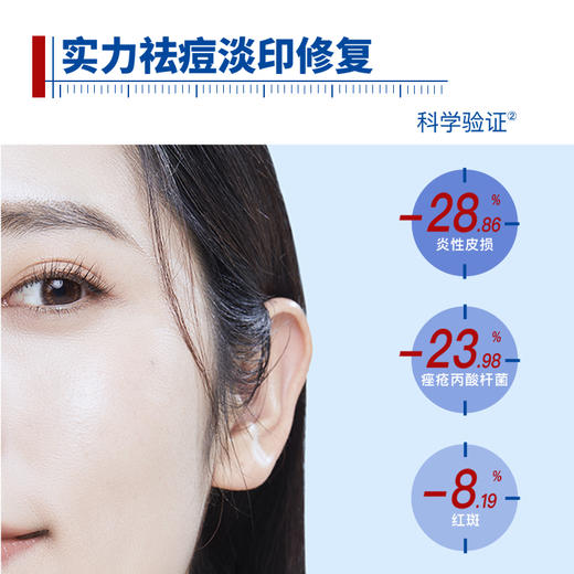 【中度痤疮/炎性丘疹/脓包】芙清 医用促愈功能性敷料（经典款面膜） 商品图2
