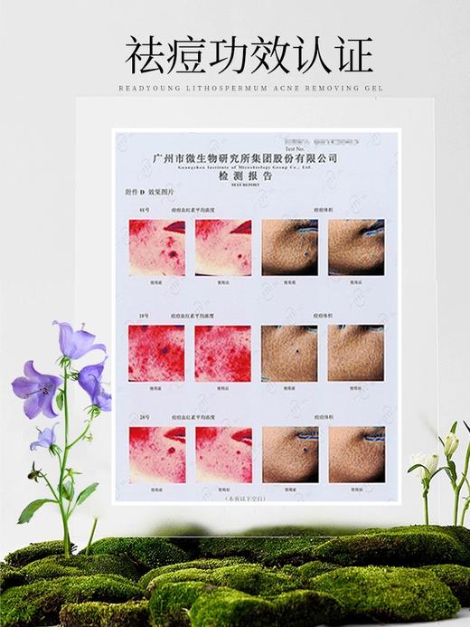 紫草净肤祛痘凝胶 15g 草本护肤 商品图4