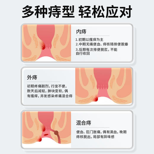 【医用痔疮敷料凝胶】纯春堂云南本草壳聚糖凝胶草本止痒痔宁肛裂便血消肉球成人消肿内外痔混合痔 商品图2