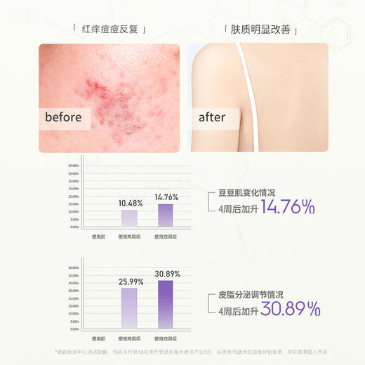 【自营】森之露除螨氨基酸控油止痒沐浴乳液 520ml（控油祛痘） 商品图1