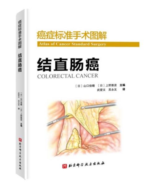 结直肠癌—癌症标准手术图解 商品图0