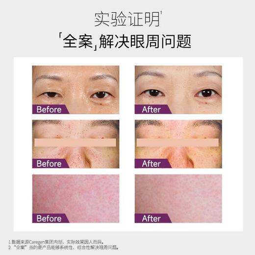 Dermaheal德玛莉 PTX肽能小白管眼霜肌活丰盈睛采眼霜局部霜15ml【该商品不支持用券】 商品图3