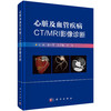 心脏及血管疾病CT/MRI影像诊断 商品缩略图0