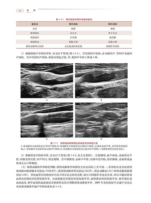 神经内科学考试指导 全国高级卫生专业技术资格正高级副高级职称人民卫生出版社正高副高人卫版神内考试指导王拥军9787117334655 商品图3