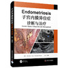 子宫内膜异位症诊断与治疗 商品缩略图0