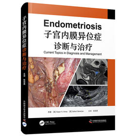 子宫内膜异位症诊断与治疗