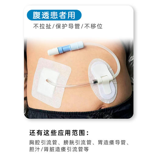 透析导管固定装置透析导管 商品图1