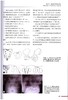 骨盆环骨折 国际经典骨科学译著 吕刚等主译 骨盆外科解剖学 急救处理骨盆C形钳 开放性骨盆骨折儿童骨盆环损伤 9787523604571  商品缩略图4