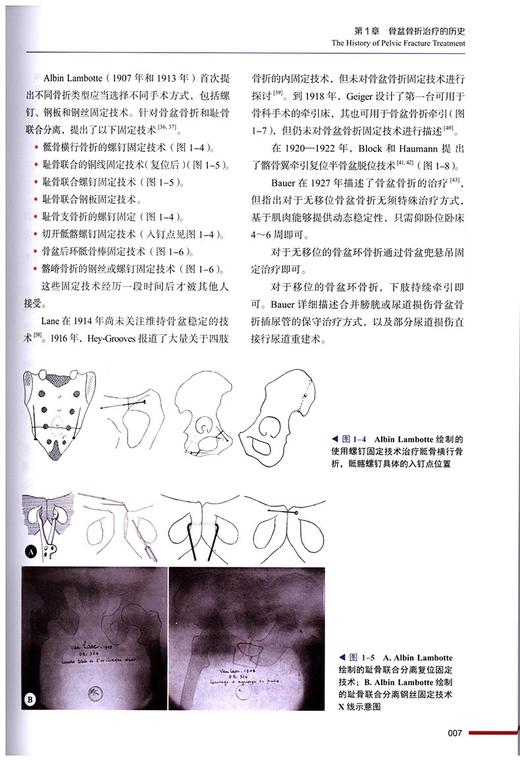 骨盆环骨折 国际经典骨科学译著 吕刚等主译 骨盆外科解剖学 急救处理骨盆C形钳 开放性骨盆骨折儿童骨盆环损伤 9787523604571  商品图4