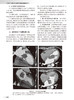 中华医学影像技术学 CT成像技术卷 第2版 高剑波 雷子乔 放射医学 CT成像检查技术诊断要点临床应用 人民卫生出版社9787117358576 商品缩略图2