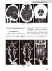 中华医学影像技术学 CT成像技术卷 第2版 高剑波 雷子乔 放射医学 CT成像检查技术诊断要点临床应用 人民卫生出版社9787117358576 商品缩略图3