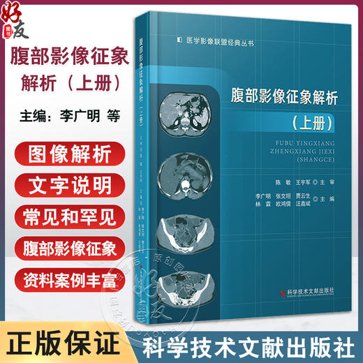 腹部影像征象解析 上册 李广明等 肝脏未分化胚胎型肉瘤 气肿性胆囊炎 肝脏平滑肌肉瘤 假性肝硬化 科学技术文献出版9787523513477 商品图0