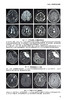 脑科学与影像新技术 张明 杨健主编 普通高等学校教材 脑科学相关高级磁共振技术临床及科研应用 人民卫生出版社9787117357968 商品缩略图3