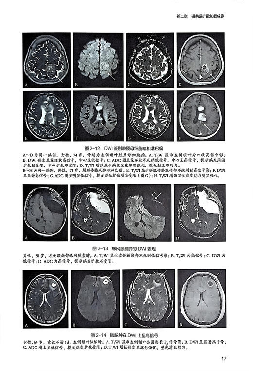 脑科学与影像新技术 张明 杨健主编 普通高等学校教材 脑科学相关高级磁共振技术临床及科研应用 人民卫生出版社9787117357968 商品图3