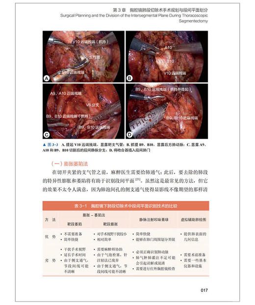 微创胸外科实用技术 微创胸外科技术 常见胸外科手术流程技术要点 术中解剖结构 术后并发症处理 中国科学技术出版社9787523606377 商品图4