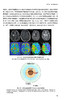 脑科学与影像新技术 张明 杨健主编 普通高等学校教材 脑科学相关高级磁共振技术临床及科研应用 人民卫生出版社9787117357968 商品缩略图4