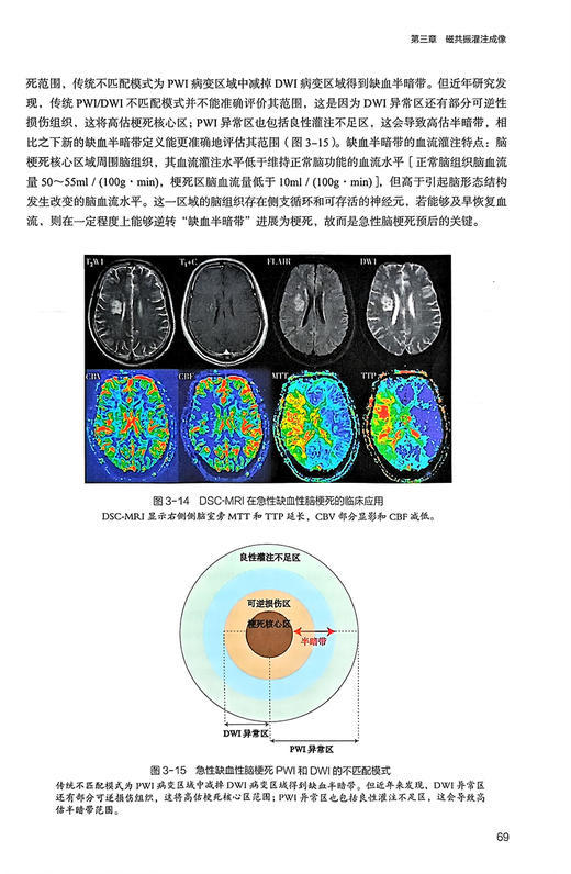 脑科学与影像新技术 张明 杨健主编 普通高等学校教材 脑科学相关高级磁共振技术临床及科研应用 人民卫生出版社9787117357968 商品图4