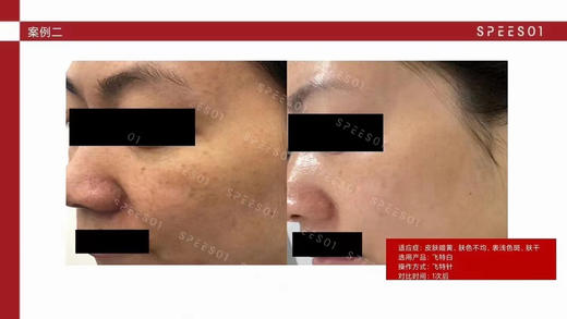 斯倍舒飞特白净斑素6ml镁白去斑 击退暗沉暗黄色沉亮肤水光 滚针 商品图5